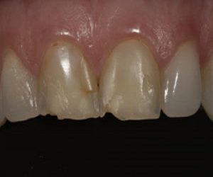 18-300x200-1